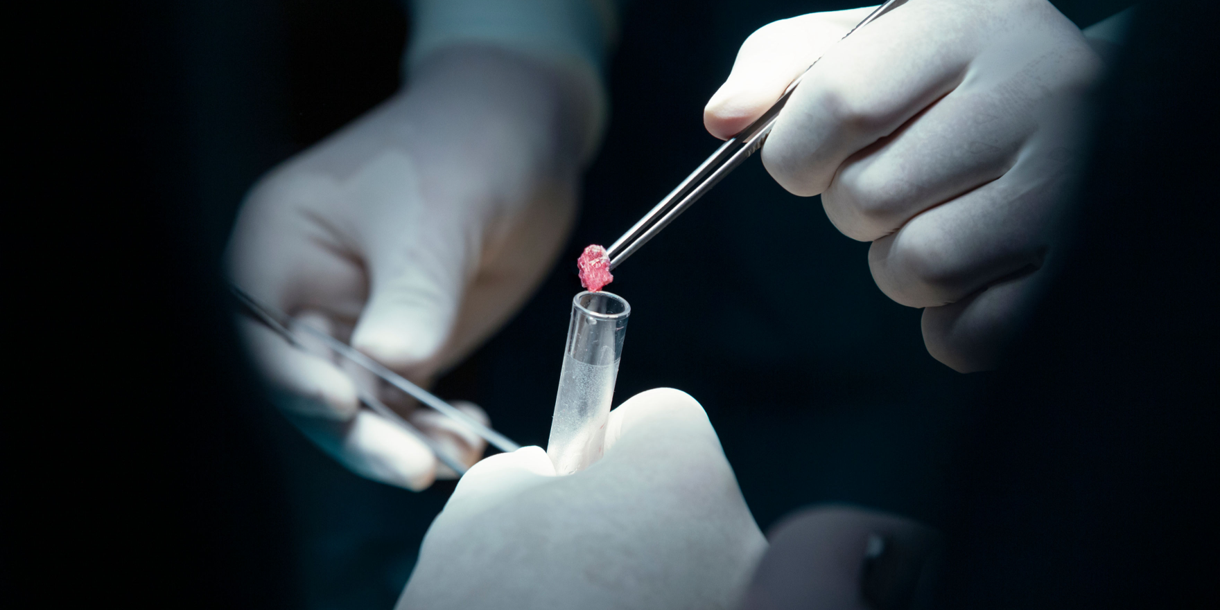 Biopsja Gruboig owa Piersi BG Feminature Warszawa Mokot w